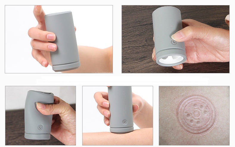 Electric Silicone Cupping