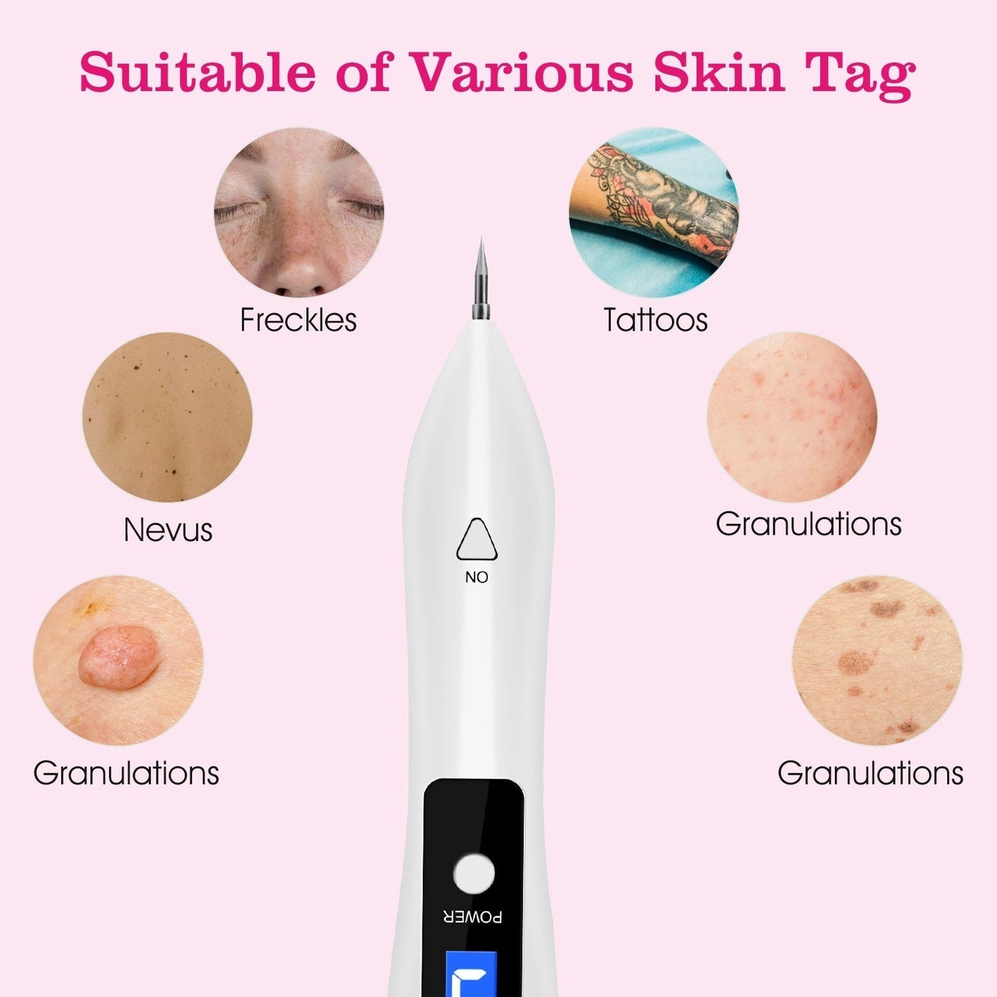 Skin Tag Repair