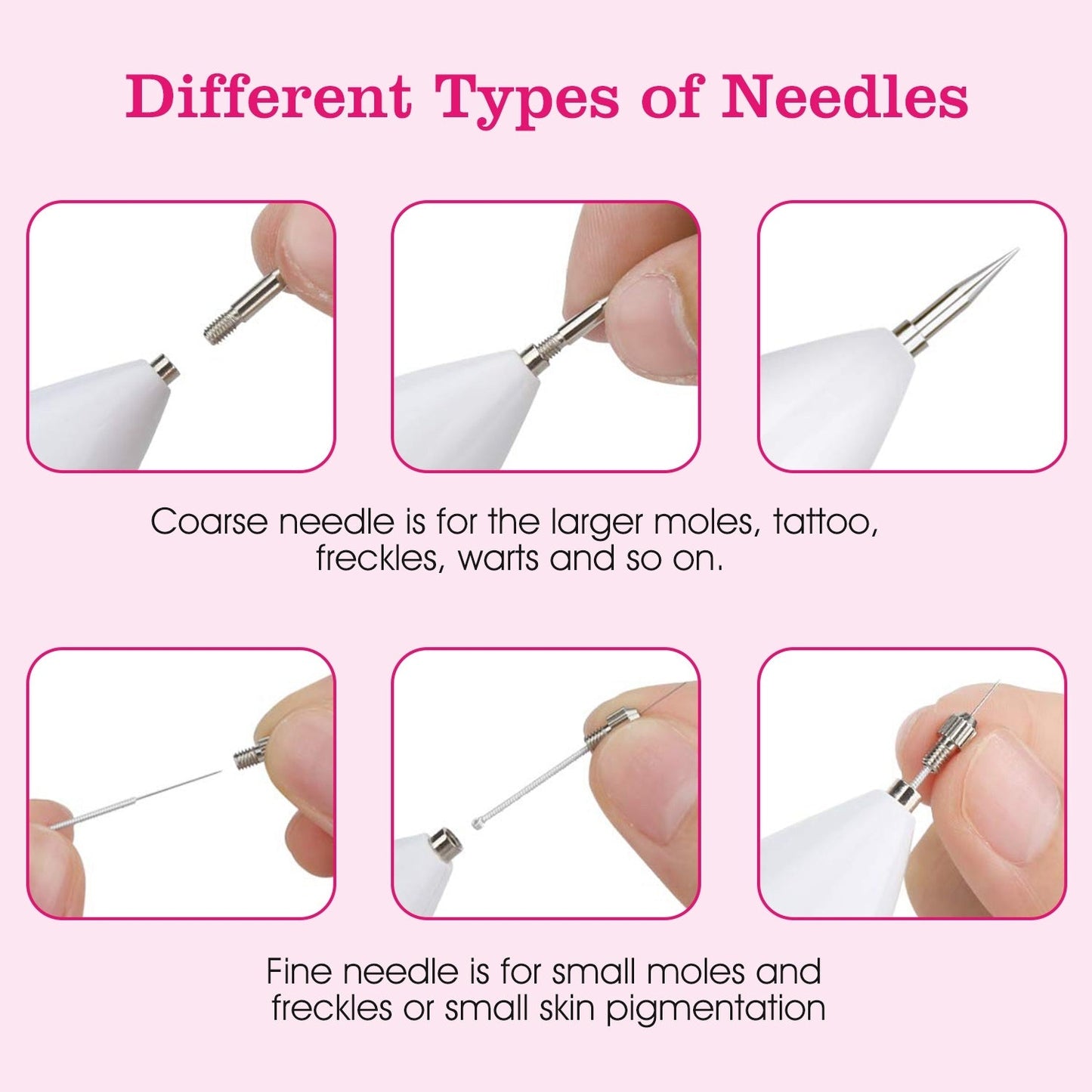 Skin Tag Repair