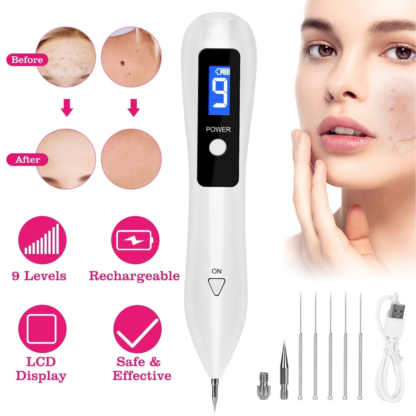Skin Tag Repair