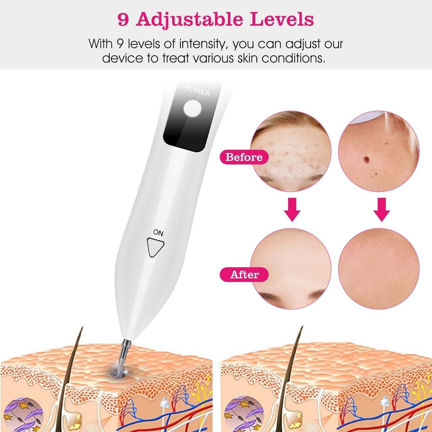 Skin Tag Repair